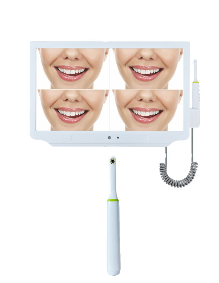 Monitor Wi-Fi con Cámara Intraoral Incorporada y Soporte