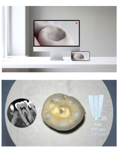 Woodpecker KP iSee Tron | Microscópio Dentário com AR 2
